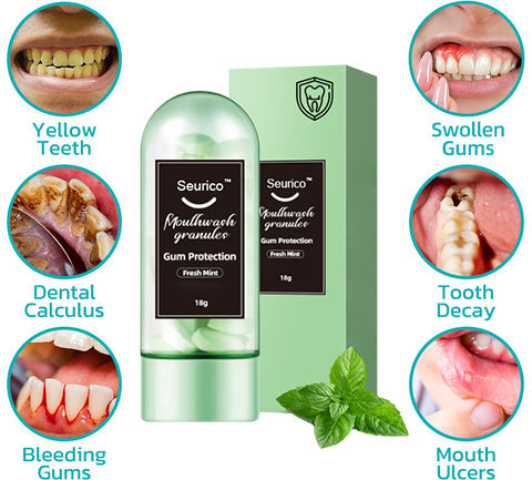 🔥Seurico™ Convenient Gum Protection Pellets (NHS support 👨‍⚕️)