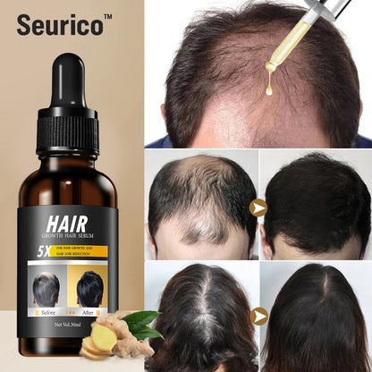Seurico™ Rapid Hair Growth Serum - Rejuvenate your hair with our proven product!