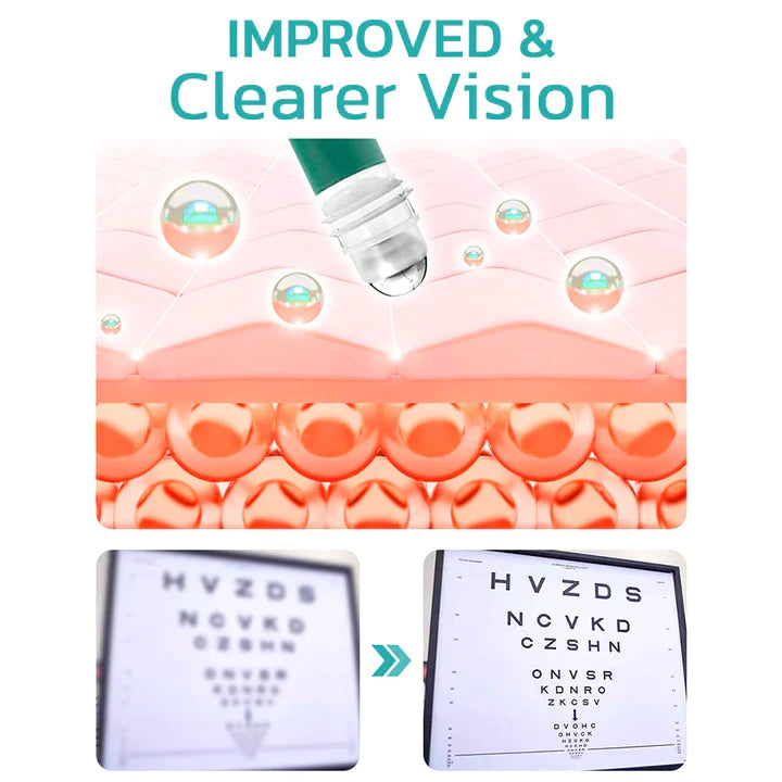 Seurico™ OphthlaMed Vision Enhance Roller